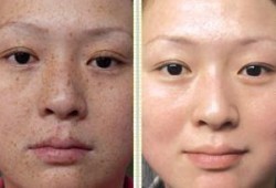 徒手祛斑爆料视频教程图片,跟随视频教程轻松告别斑点困扰